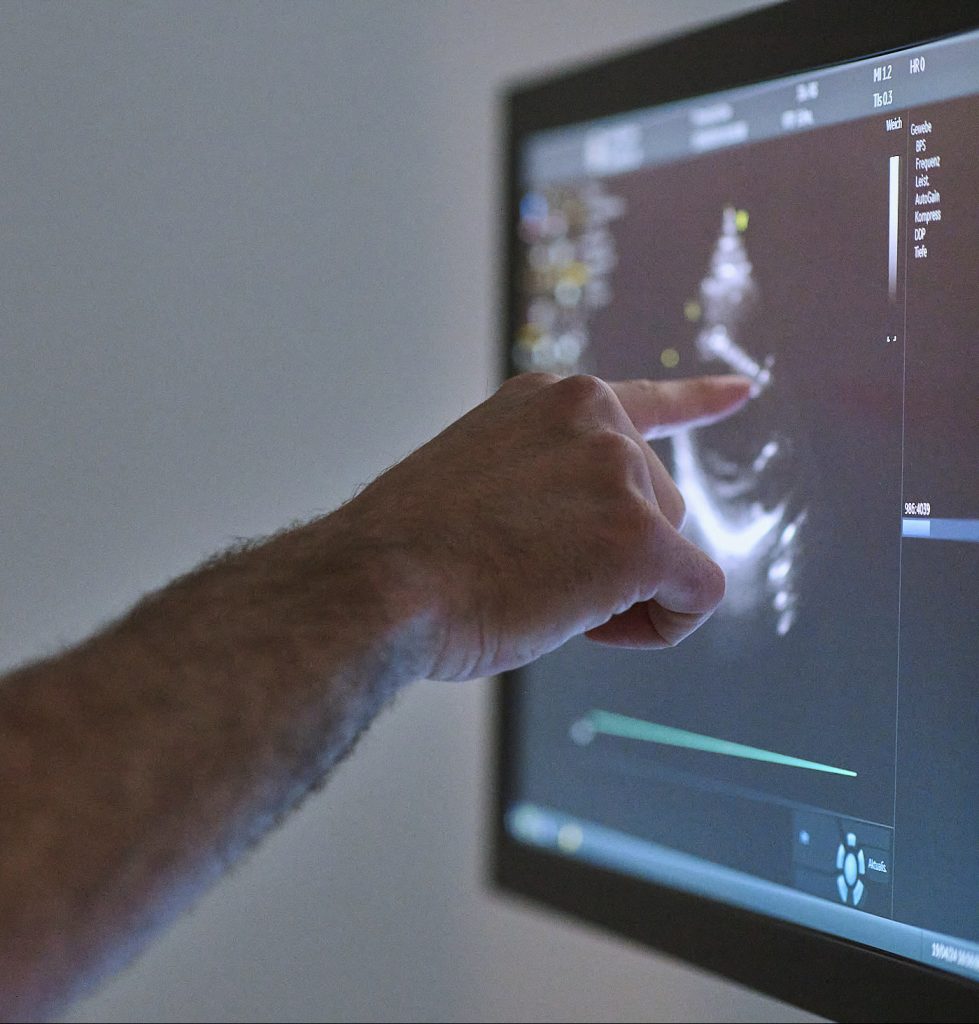 Eine Hand zeigt auf einen Ultraschallbildschirm, der medizinische Bildgebung anzeigt. Der Bildschirm befindet sich in einem klinischen oder diagnostischen Raum.